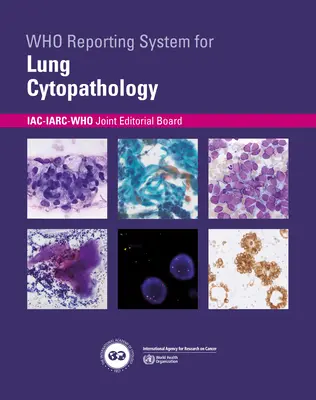 A tüdő citopatológiájának jelentési rendszere - Who Reporting System for Lung Cytopathology
