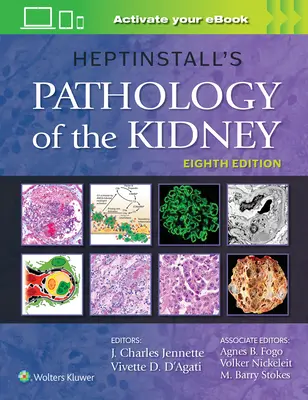 Heptinstall: A vese patológiája - Heptinstall's Pathology of the Kidney