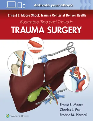 Ernest E. Moore Shock Trauma Center at Denver Health Illusztrált tippek és trükkök a baleseti sebészetben - Ernest E. Moore Shock Trauma Center at Denver Health Illustrated Tips and Tricks in Trauma Surgery