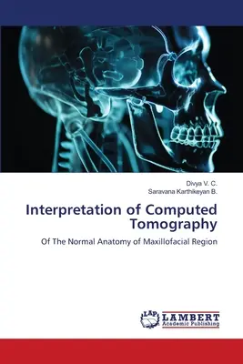 A komputertomográfia értelmezése - Interpretation of Computed Tomography