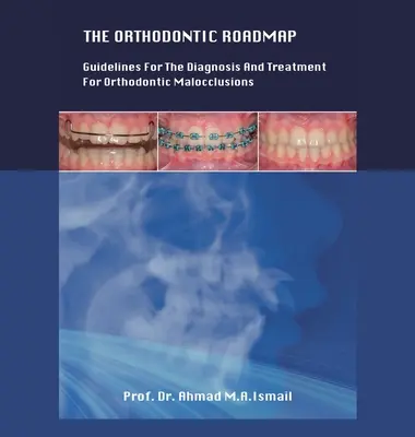 A fogszabályozási útiterv: Irányelvek a fogszabályozási hibák diagnosztizálásához és kezeléséhez - The Orthodontic Roadmap: Guidelines for the Diagnosis and Treatment of Orthodontic Malocclusions