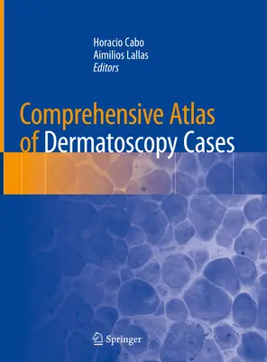 A bőrgyógyászati esetek átfogó atlasza - Comprehensive Atlas of Dermatoscopy Cases