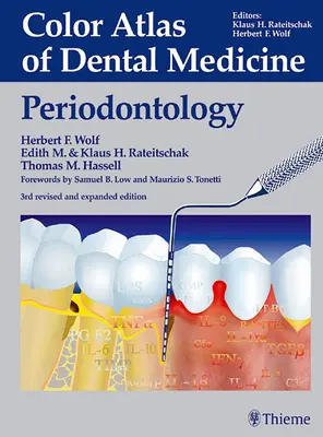 A fogászati orvostudomány színes atlasza: Periodontology - Color Atlas of Dental Medicine: Periodontology