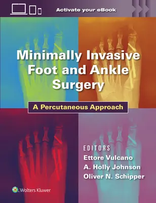 Minimálisan invazív láb- és bokaműtét: Percutan megközelítés - Minimally Invasive Foot and Ankle Surgery: A Percutaneous Approach