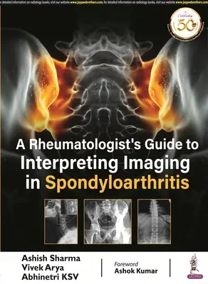 A reumatológus útmutatója a spondyloarthritis képalkotó eljárásainak értelmezéséhez - Rheumatologist's Guide to Interpreting Imaging in Spondyloarthritis