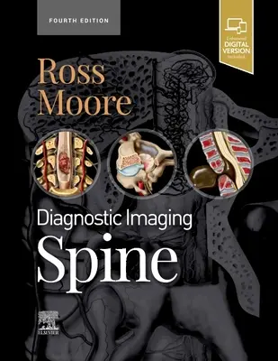 Diagnosztikai képalkotás: Gerinc (Ross Jeffrey S. (A radiológia professzora Mayo Clinic College Rochester Minnesota)) - Diagnostic Imaging: Spine (Ross Jeffrey S. (Professor of Radiology Mayo Clinic College Rochester Minnesota))