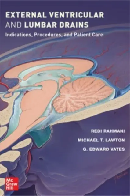 Külső kamrai és ágyéki drének: Indikációk, eljárások és betegellátás - External Ventricular and Lumbar Drains: Indications, Procedures, and Patient Care