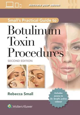 Small gyakorlati útmutatója a botulinumtoxin-eljárásokhoz - Small's Practical Guide to Botulinum Toxin Procedures