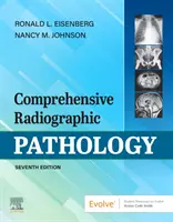 Átfogó röntgenpatológia - Comprehensive Radiographic Pathology