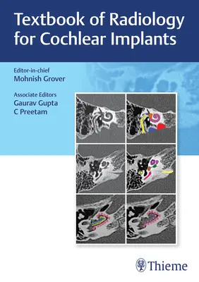 A cochleáris implantátumok radiológiájának tankönyve - Textbook of Radiology for Cochlear Implants