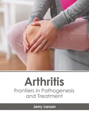 Arthritis: A patogenezis és a kezelés határai - Arthritis: Frontiers in Pathogenesis and Treatment