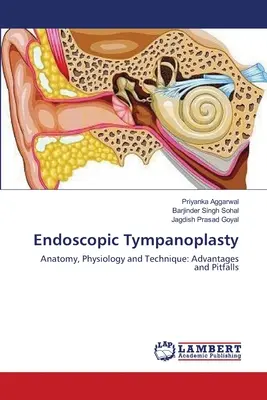 Endoszkópos tympanoplasztika - Endoscopic Tympanoplasty