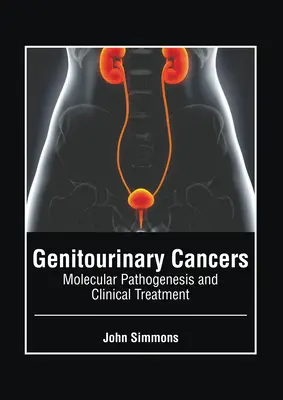 Genitourinary Cancers (urogenitális rákok): Molekuláris patogenezis és klinikai kezelés - Genitourinary Cancers: Molecular Pathogenesis and Clinical Treatment