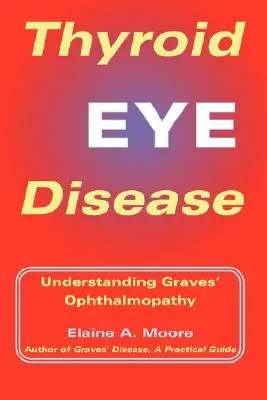 A pajzsmirigy szembetegség: A Graves-szemészeti betegség megértése - Thyroid Eye Disease: Understanding Graves' Ophthalmopathy