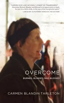 Overcome: Megégve, megvakulva és megáldva - Overcome: Burned, Blinded, and Blessed