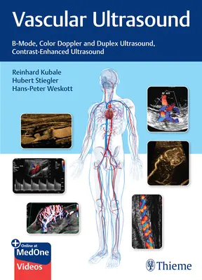 Vascular Ultrasound: B-mód, színes Doppler és Duplex ultrahang, kontraszt-erősített ultrahang - Vascular Ultrasound: B-Mode, Color Doppler and Duplex Ultrasound, Contrast-Enhanced Ultrasound