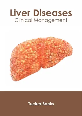 Májbetegségek: Májbetegség: Klinikai kezelés - Liver Diseases: Clinical Management