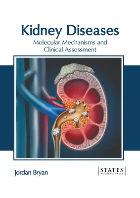 Vesebetegségek: Molekuláris mechanizmusok és klinikai értékelés - Kidney Diseases: Molecular Mechanisms and Clinical Assessment