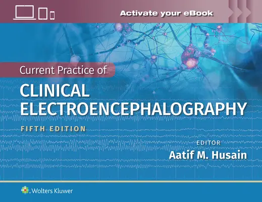 A klinikai elektroenkefalográfia jelenlegi gyakorlata - Current Practice of Clinical Electroencephalography