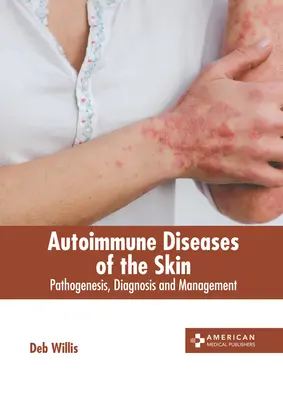 A bőr autoimmun betegségei: Pathogenezis, diagnózis és kezelés - Autoimmune Diseases of the Skin: Pathogenesis, Diagnosis and Management