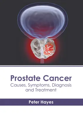 Prosztatarák: Prosztata: Okok, tünetek, diagnózis és kezelés - Prostate Cancer: Causes, Symptoms, Diagnosis and Treatment