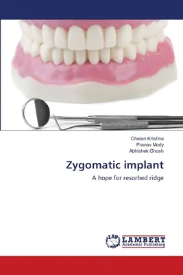 Járomcsont-implantátum - Zygomatic implant