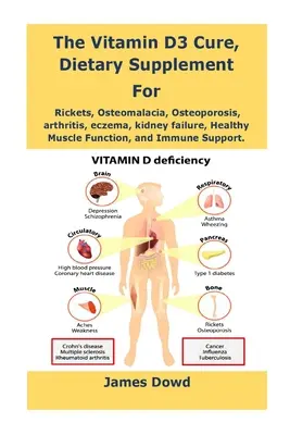 Lék s vitamínem D3, doplněk stravy pro nemocné s křečemi, osteomalacii, osteoporózu, artritidu, ekzémy, selhání ledvin, zdravou funkci svalů a imunitu - The Vitamin D3 Cure, Dietary supplement for Rickets, Osteomalacia, Osteoporosis, arthritis, eczema, kidney failure, Healthy Muscle Function, and Immun