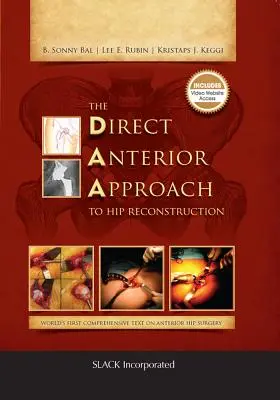 A csípőrekonstrukció közvetlen elülső megközelítése - The Direct Anterior Approach to Hip Reconstruction