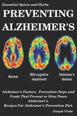 Az Alzheimer-kór megelőzése: Alzheimer-tényezők, megelőzési lépések és élelmiszerek, amelyek megelőzik vagy lassítják az Alzheimer-kórt, receptek az Alzheimer megelőzéséhez D - Preventing Alzheimer's: Alzheimer's Factors, Prevention Steps and Foods That Prevent or Slow Alzheimer's, Recipes for Alzheimer's Prevention D