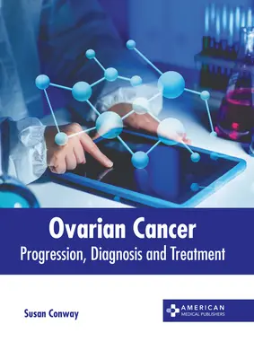 Petefészekrák: Petefészek: Progresszió, diagnózis és kezelés - Ovarian Cancer: Progression, Diagnosis and Treatment