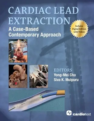 Szívizom kivonás: A Case-Based Contemporary Approach - Cardiac Lead Extraction: A Case-Based Contemporary Approach