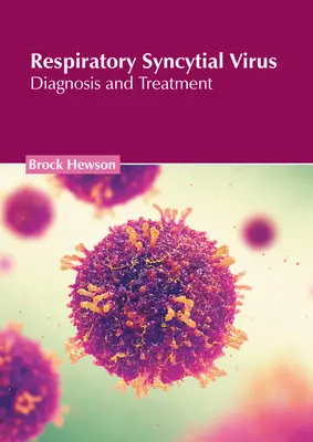 Légúti szinciális vírus: Szirtiális vírusfertőzés: Diagnózis és kezelés - Respiratory Syncytial Virus: Diagnosis and Treatment