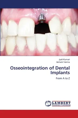 A fogászati implantátumok osszeointegrációja - Osseointegration of Dental Implants