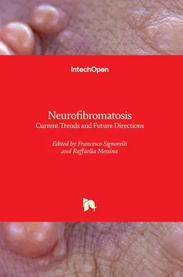 Neurofibromatózis: Fibromfibromfibromfibrom: Jelenlegi tendenciák és jövőbeli irányok - Neurofibromatosis: Current Trends and Future Directions