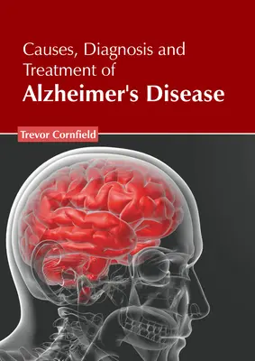 Az Alzheimer-kór okai, diagnózisa és kezelése - Causes, Diagnosis and Treatment of Alzheimer's Disease