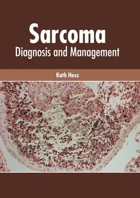 Szarkóma: Diagnózis és kezelés - Sarcoma: Diagnosis and Management