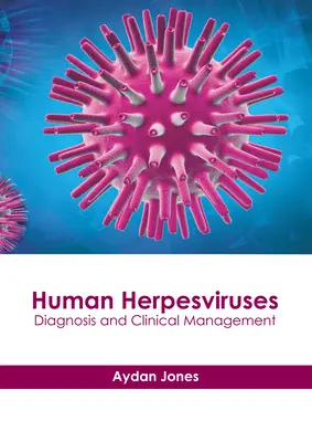 Humán herpeszvírusok: Diagnózis és klinikai kezelés - Human Herpesviruses: Diagnosis and Clinical Management