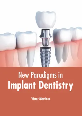 Új paradigmák az implantációs fogászatban - New Paradigms in Implant Dentistry