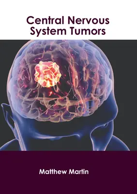 Központi idegrendszeri daganatok - Central Nervous System Tumors