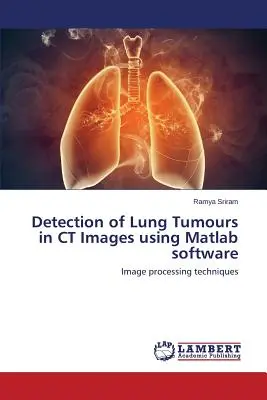 A tüdődaganatok kimutatása CT-képeken Matlab szoftverrel - Detection of Lung Tumours in CT Images using Matlab software