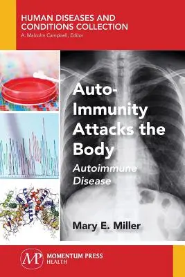 Az autoimmunitás megtámadja a testet: Autoimmun betegség - Auto-Immunity Attacks the Body: Autoimmune Disease