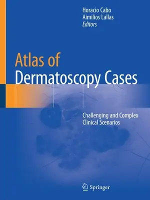 A bőrgyógyászati esetek atlasza: Kihívást jelentő és összetett klinikai forgatókönyvek - Atlas of Dermatoscopy Cases: Challenging and Complex Clinical Scenarios