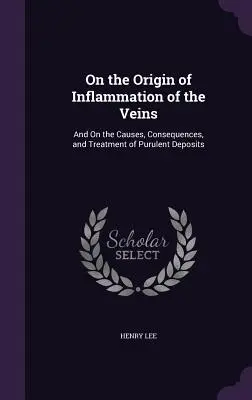 A vénák gyulladásának eredetéről: És a gennyes lerakódások okairól, következményeiről és kezeléséről - On the Origin of Inflammation of the Veins: And On the Causes, Consequences, and Treatment of Purulent Deposits