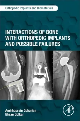 A csont és az ortopédiai implantátumok kölcsönhatásai és lehetséges hibái - Interactions of Bone with Orthopedic Implants and Possible Failures