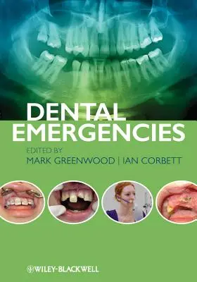 Fogászati vészhelyzetek - Dental Emergencies