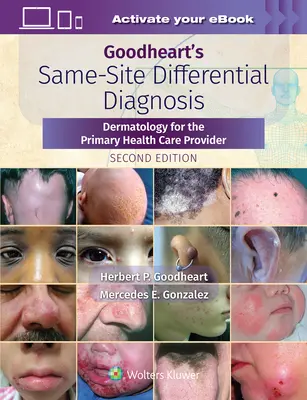 Goodheart's Same-Site Differential Diagnosis: Bőrgyógyászat az egészségügyi alapellátó számára - Goodheart's Same-Site Differential Diagnosis: Dermatology for the Primary Health Care Provider