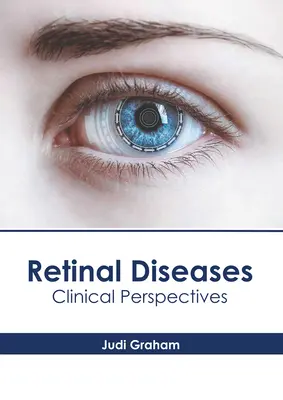 Retina betegségek: Klinikai perspektívák - Retinal Diseases: Clinical Perspectives