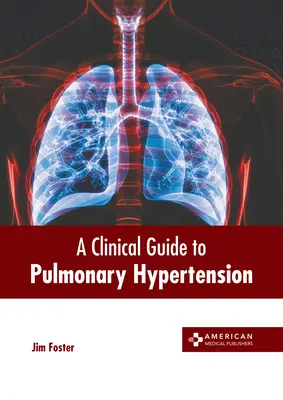 A tüdőhipertónia klinikai útmutatója - A Clinical Guide to Pulmonary Hypertension