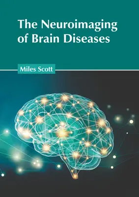 Az agyi betegségek képalkotása - The Neuroimaging of Brain Diseases