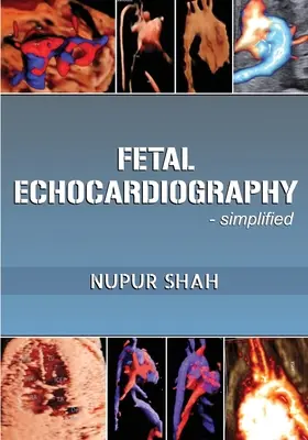 Magzati echokardiográfia - egyszerűsítve - Fetal Echocardiography - Simplified